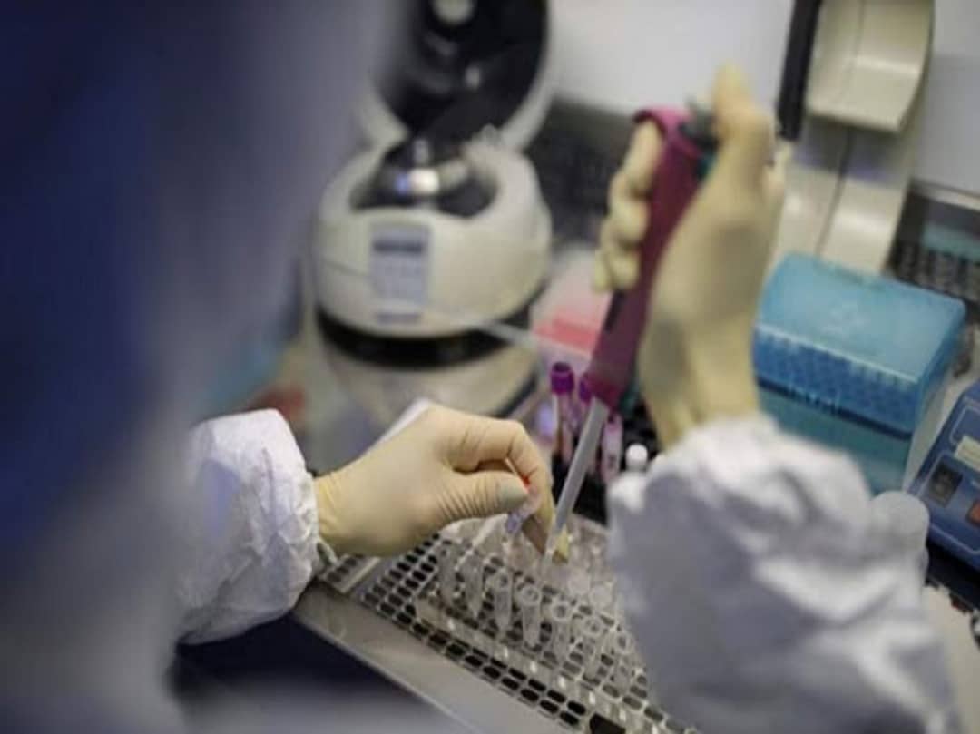 راه‌اندازی آزمایشگاه تشخیص مولکولی کرونا ویروس جدید در استان ایلام