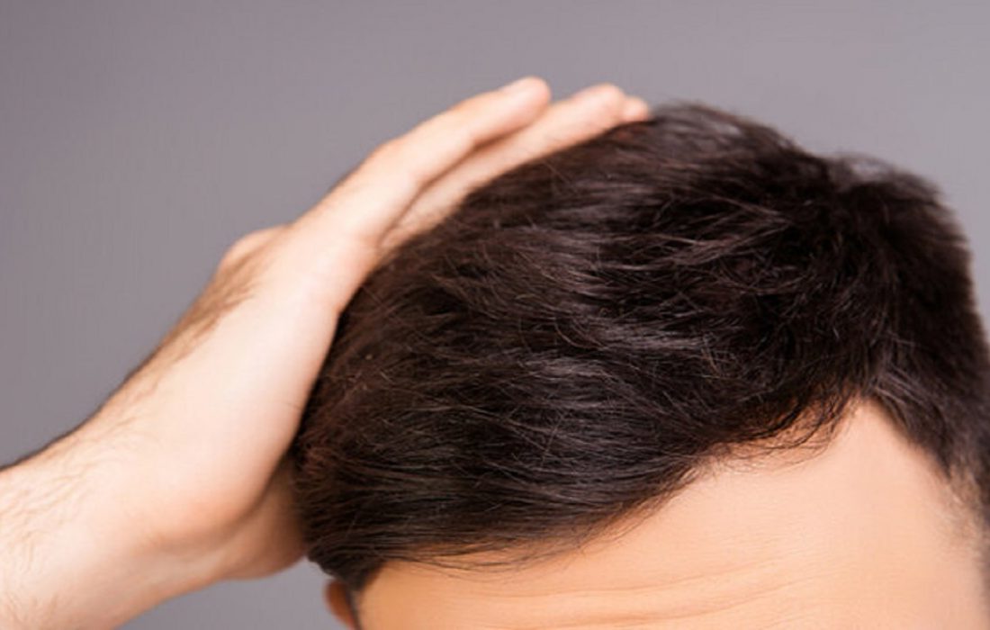 رژیم غذایی فوقالعاده برای افزایش رشد مو
