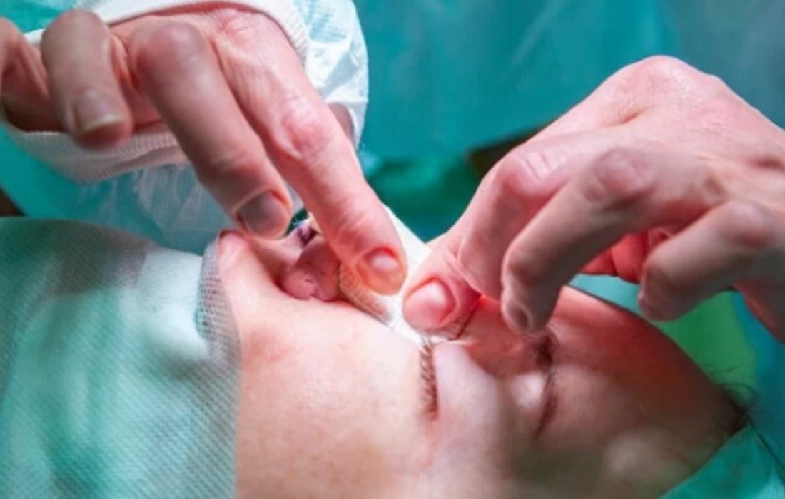 چه افرادی نباید بینی خود را عمل کنند؟