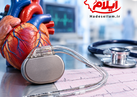 هزینه ۱۴ میلیونی بیماران قلبی ایلام برای یک آنالیز/ پای کمبود پزشک متخصص در میان است
